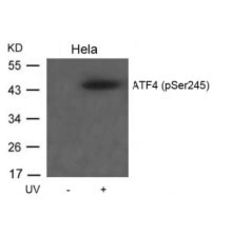 Western blot - ATF4 (Phospho-Ser245) Antibody from Signalway Antibody (11053) - Antibodies.com