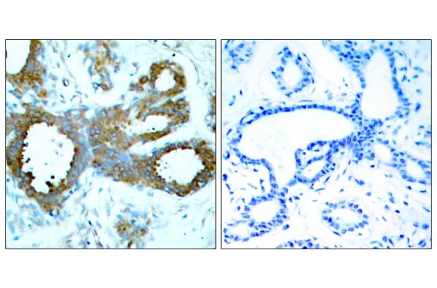 Immunohistochemistry - PAK1/PAK2/PAK3 (Phospho-Thr423/Thr402/Thr421) Antibody from Signalway Antibody (11165)