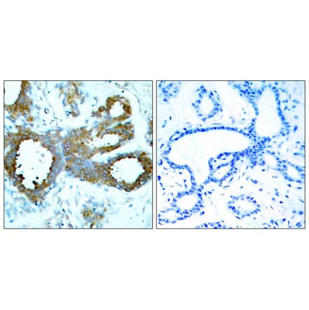 Immunohistochemistry - PAK1/PAK2/PAK3 (Phospho-Thr423/Thr402/Thr421) Antibody from Signalway Antibody (11165)