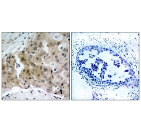 Immunohistochemistry - VEGFR2 (Phospho-Tyr1175) Antibody from Signalway Antibody (11084) - Antibodies.com