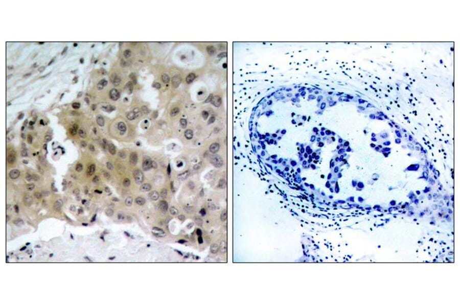 Immunohistochemistry - VEGFR2 (Phospho-Tyr1175) Antibody from Signalway Antibody (11084) - Antibodies.com