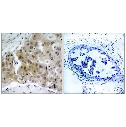 Immunohistochemistry - VEGFR2 (Phospho-Tyr1175) Antibody from Signalway Antibody (11084) - Antibodies.com