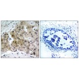 Immunohistochemistry - VEGFR2 (Phospho-Tyr1175) Antibody from Signalway Antibody (11084) - Antibodies.com