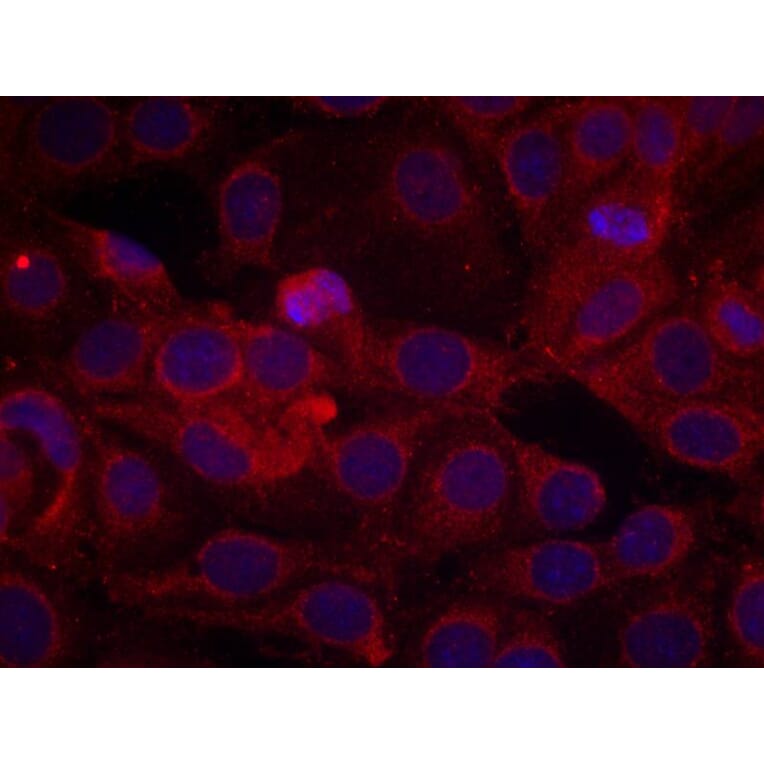 Immunofluorescence - VEGFR2 (Phospho-Tyr1175) Antibody from Signalway Antibody (11084) - Antibodies.com