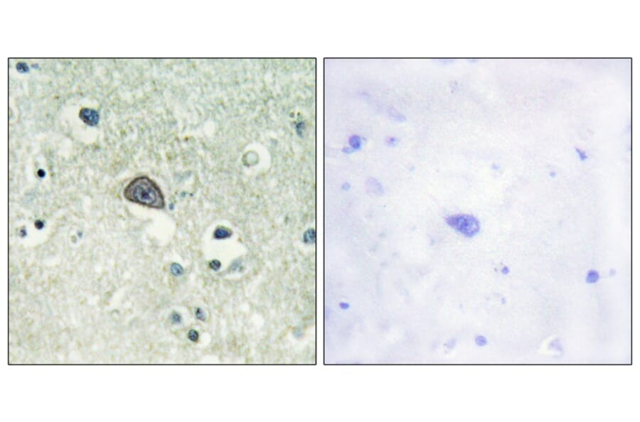 Immunohistochemistry - NMDAR1 (Phospho-Ser890) Antibody from Signalway Antibody (11674) - Antibodies.com