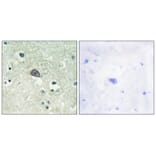 Immunohistochemistry - NMDAR1 (Phospho-Ser890) Antibody from Signalway Antibody (11674) - Antibodies.com
