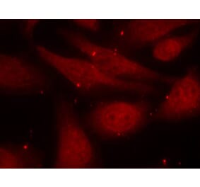 Immunofluorescence - c-Abl (Phospho-Tyr412) Antibody from Signalway Antibody (11125) - Antibodies.com