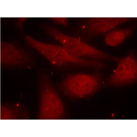 Immunofluorescence - c-Abl (Phospho-Tyr412) Antibody from Signalway Antibody (11125) - Antibodies.com