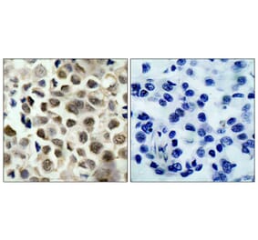 Immunohistochemistry - HDAC8 (Phospho-Ser39) Antibody from Signalway Antibody (11128) - Antibodies.com