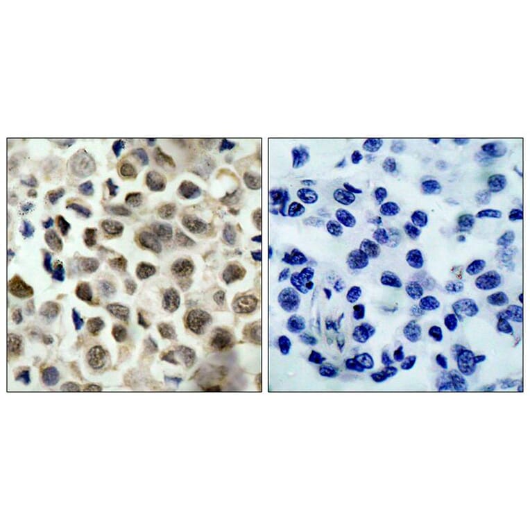 Immunohistochemistry - HDAC8 (Phospho-Ser39) Antibody from Signalway Antibody (11128) - Antibodies.com