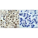 Immunohistochemistry - HDAC8 (Phospho-Ser39) Antibody from Signalway Antibody (11128) - Antibodies.com