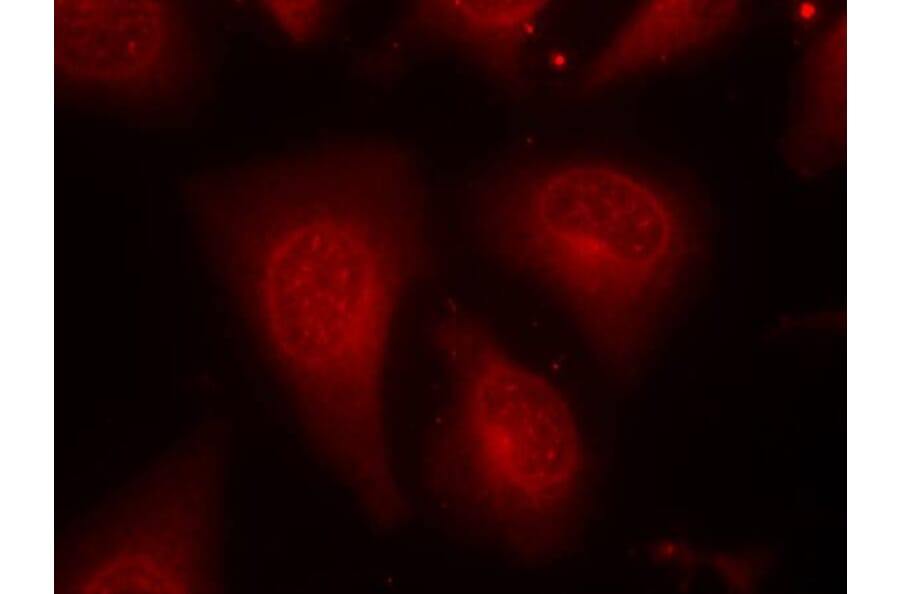 Immunofluorescence - HDAC8 (Phospho-Ser39) Antibody from Signalway Antibody (11128) - Antibodies.com
