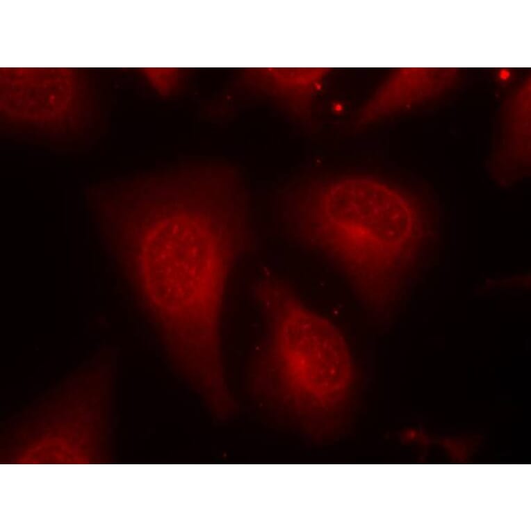 Immunofluorescence - HDAC8 (Phospho-Ser39) Antibody from Signalway Antibody (11128) - Antibodies.com