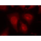 Immunofluorescence - HDAC8 (Phospho-Ser39) Antibody from Signalway Antibody (11128) - Antibodies.com