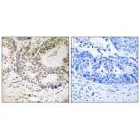 Immunohistochemistry - 53BP1 (Phospho-Ser25) Antibody from Signalway Antibody (12125) - Antibodies.com