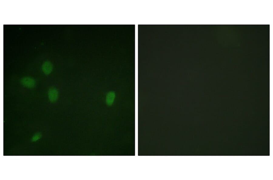 Immunofluorescence - 53BP1 (Phospho-Ser25) Antibody from Signalway Antibody (12125) - Antibodies.com