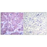 Immunohistochemistry - PTEN (Phospho-Ser380) Antibody from Signalway Antibody (11009) - Antibodies.com