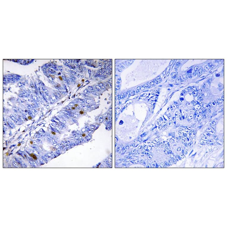 Immunohistochemistry - Nuclear Receptor NR4A1 (Phospho-Ser351) Antibody from Signalway Antibody - Antibodies.com