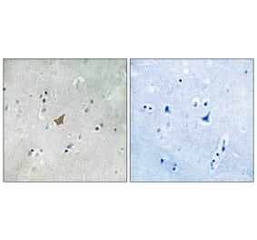Immunohistochemistry - EPHA3/4/5 (Phospho-Tyr779/833) Antibody from Signalway Antibody (11729) - Antibodies.com
