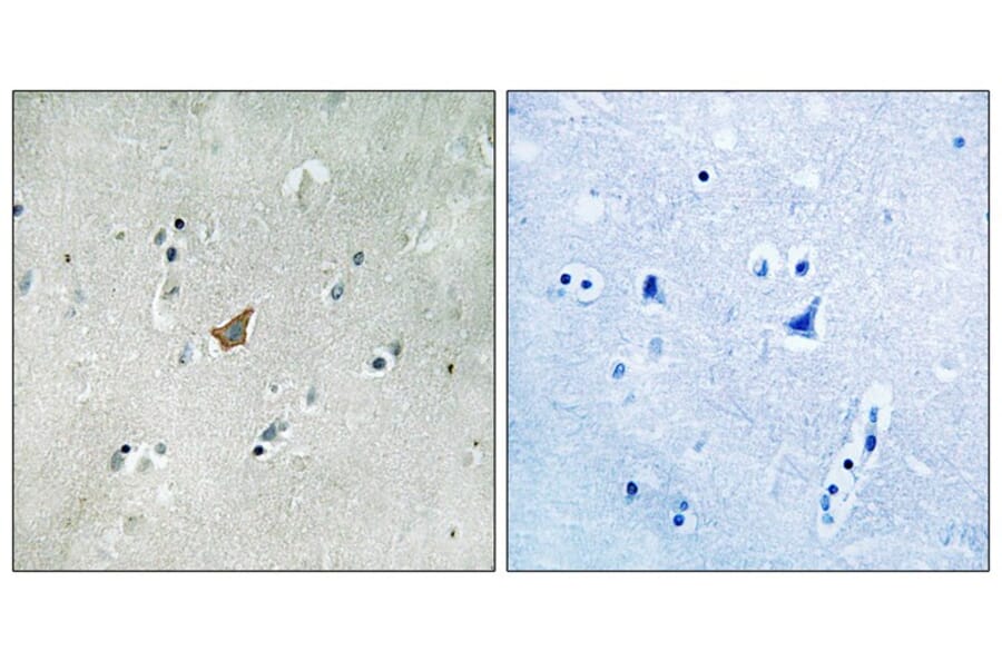 Immunohistochemistry - EPHA3/4/5 (Phospho-Tyr779/833) Antibody from Signalway Antibody (11729) - Antibodies.com