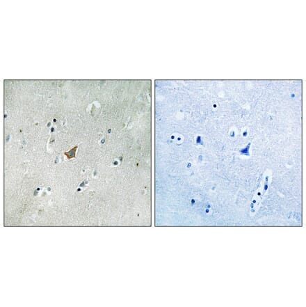 Immunohistochemistry - EPHA3/4/5 (Phospho-Tyr779/833) Antibody from Signalway Antibody (11729) - Antibodies.com