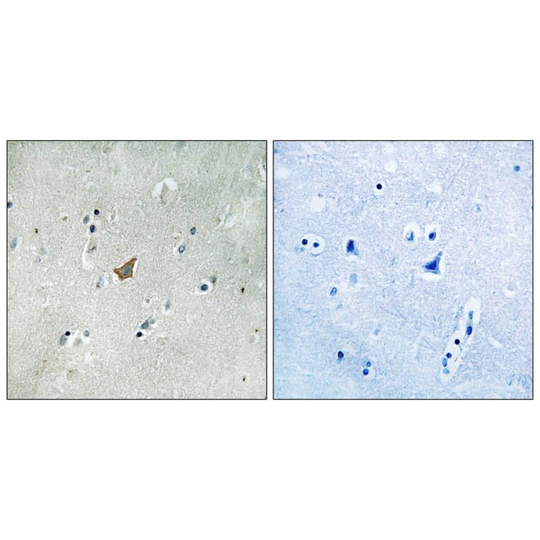 Immunohistochemistry - EPHA3/4/5 (Phospho-Tyr779/833) Antibody from Signalway Antibody (11729) - Antibodies.com