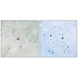 Immunohistochemistry - EPHA3/4/5 (Phospho-Tyr779/833) Antibody from Signalway Antibody (11729) - Antibodies.com