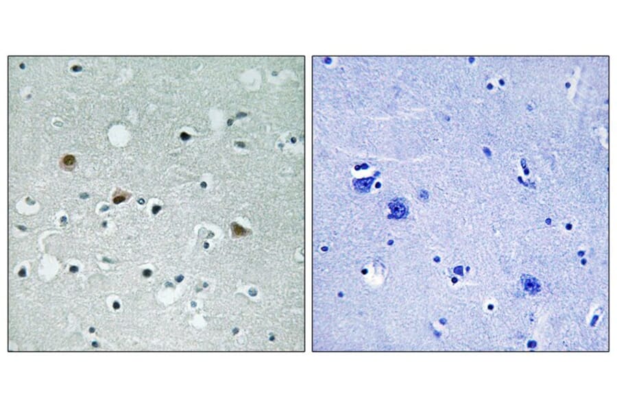 Immunohistochemistry - LATS1/2 (Phospho-Thr1079/1041) Antibody from Signalway Antibody (11736) - Antibodies.com