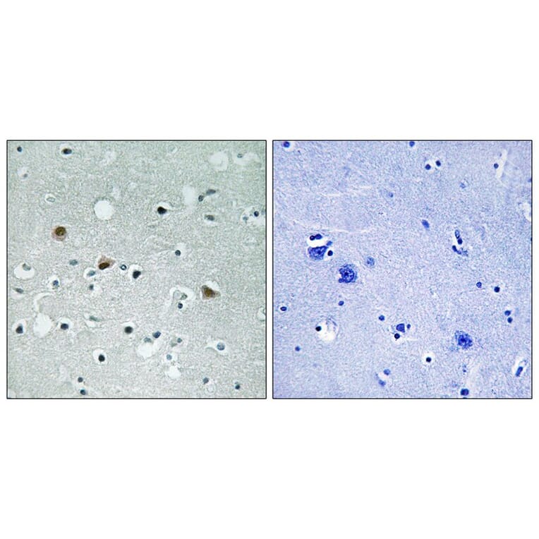 Immunohistochemistry - LATS1/2 (Phospho-Thr1079/1041) Antibody from Signalway Antibody (11736) - Antibodies.com