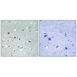 Immunohistochemistry - LATS1/2 (Phospho-Thr1079/1041) Antibody from Signalway Antibody (11736) - Antibodies.com