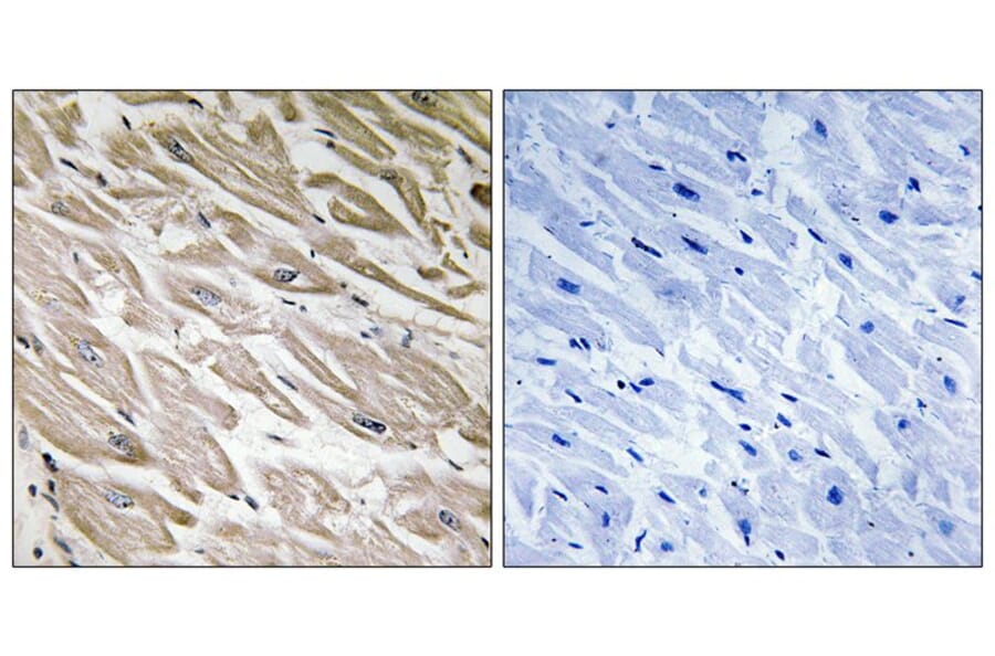 Immunohistochemistry - PPP1R2 (Phospho-Ser120/Ser121) Antibody from Signalway Antibody (12150) - Antibodies.com