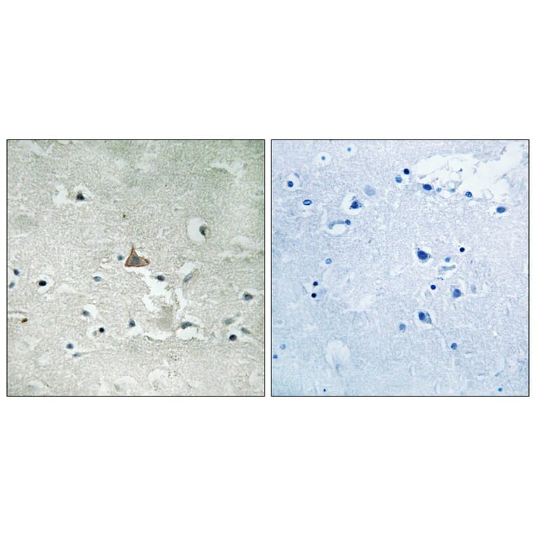 Immunohistochemistry - Trk B (Phospho-Tyr706/Tyr707) Antibody from Signalway Antibody (11758) - Antibodies.com