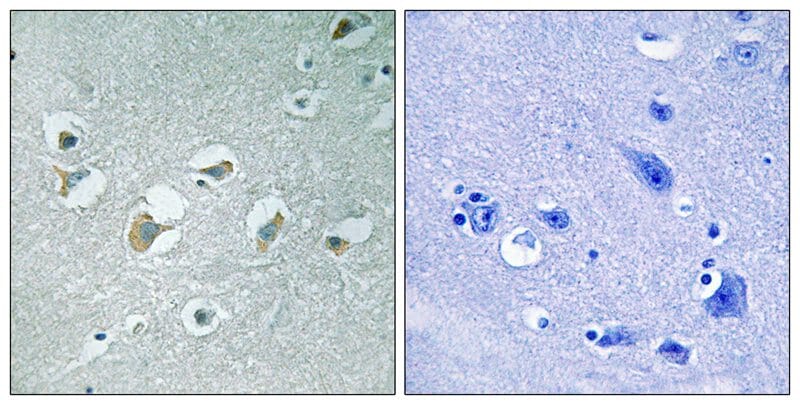Immunohistochemical analysis of paraffin-embedded human brain tissue using MLK1/2 (Phospho-Thr312/266) antibody #11744 (left)or the same antibody preincubated with blocking peptide (right).