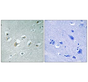 Immunohistochemistry - MLK1/2 (Phospho-Thr312/266) Antibody from Signalway Antibody (11744) - Antibodies.com