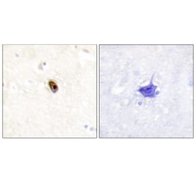 Immunohistochemistry - AurB/C (Phospho-Thr236/202) Antibody from Signalway Antibody (12111) - Antibodies.com