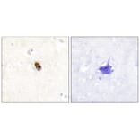 Immunohistochemistry - AurB/C (Phospho-Thr236/202) Antibody from Signalway Antibody (12111) - Antibodies.com
