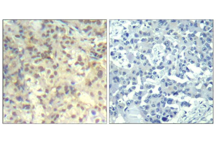 Immunohistochemistry - cofilin1 (phospho-Tyr139) Antibody from Signalway Antibody (11506) - Antibodies.com