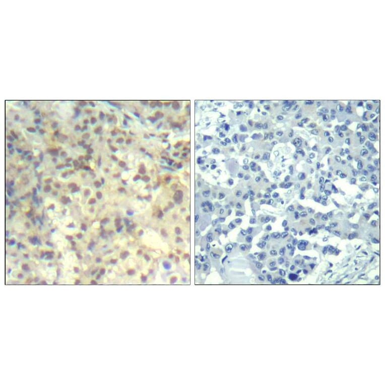Immunohistochemistry - cofilin1 (phospho-Tyr139) Antibody from Signalway Antibody (11506) - Antibodies.com