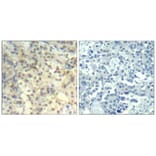 Immunohistochemistry - cofilin1 (phospho-Tyr139) Antibody from Signalway Antibody (11506) - Antibodies.com