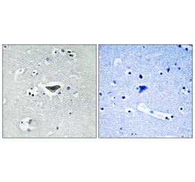 Immunohistochemistry - Ras-GRF1 (Phospho-Ser916) Antibody from Signalway Antibody (11678) - Antibodies.com