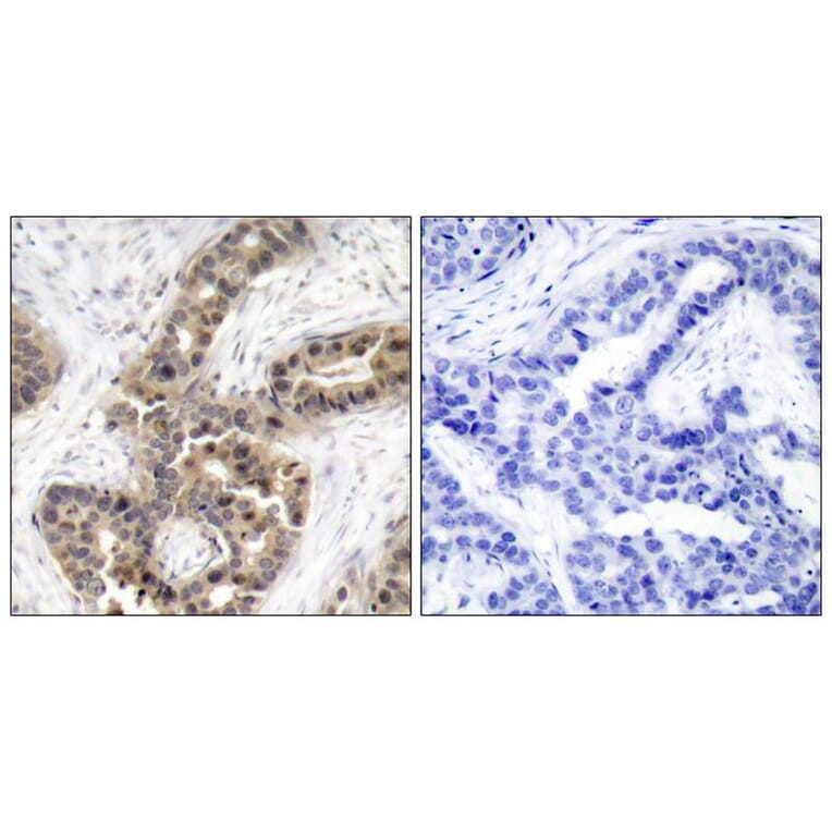 Immunohistochemistry - p21Cip1 (Phospho-Thr145) Antibody from Signalway Antibody (11206) - Antibodies.com