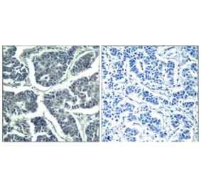 Immunohistochemistry - PLCg2 (phospho-Tyr1217) Antibody from Signalway Antibody (11524) - Antibodies.com