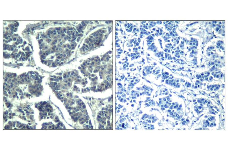 Immunohistochemistry - PLCg2 (phospho-Tyr1217) Antibody from Signalway Antibody (11524) - Antibodies.com