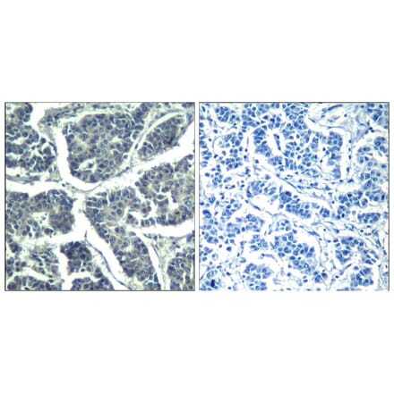 Immunohistochemistry - PLCg2 (phospho-Tyr1217) Antibody from Signalway Antibody (11524) - Antibodies.com
