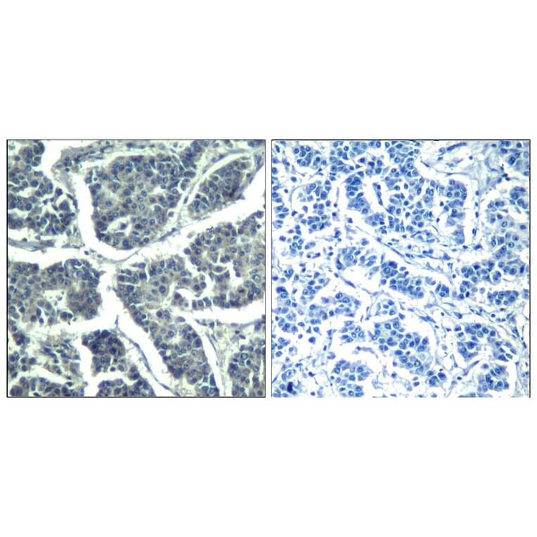 Immunohistochemistry - PLCg2 (phospho-Tyr1217) Antibody from Signalway Antibody (11524) - Antibodies.com