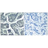 Immunohistochemistry - PLCg2 (phospho-Tyr1217) Antibody from Signalway Antibody (11524) - Antibodies.com