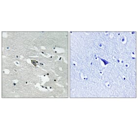 Immunohistochemistry - VEGFR1 (Phospho-Tyr1048) Antibody from Signalway Antibody (11759) - Antibodies.com