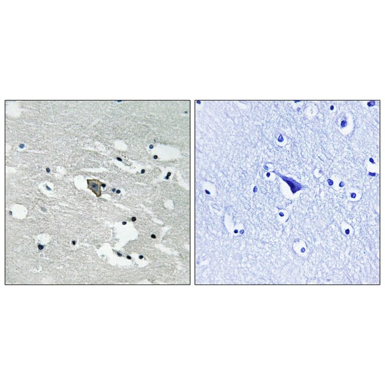Immunohistochemistry - VEGFR1 (Phospho-Tyr1048) Antibody from Signalway Antibody (11759) - Antibodies.com