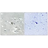 Immunohistochemistry - VEGFR1 (Phospho-Tyr1048) Antibody from Signalway Antibody (11759) - Antibodies.com