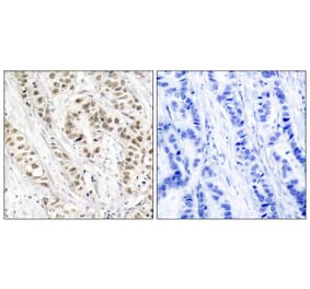 Immunohistochemistry - BRCA1 (Phospho-Ser1524) Antibody from Signalway Antibody (11117) - Antibodies.com